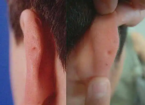 耳朵上有小孔和大舌头需要关注下