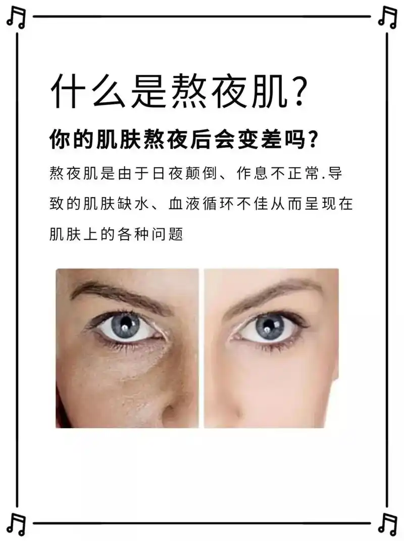 如果你也经常熬夜导致皮肤差的话,快过来好好看 - 抖音
