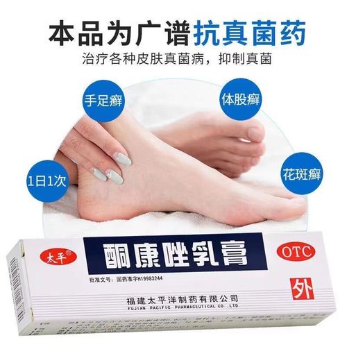 手足癣脚气软膏 体癣股藓花斑癣 皮肤念珠菌病 抗真菌感染外用药膏