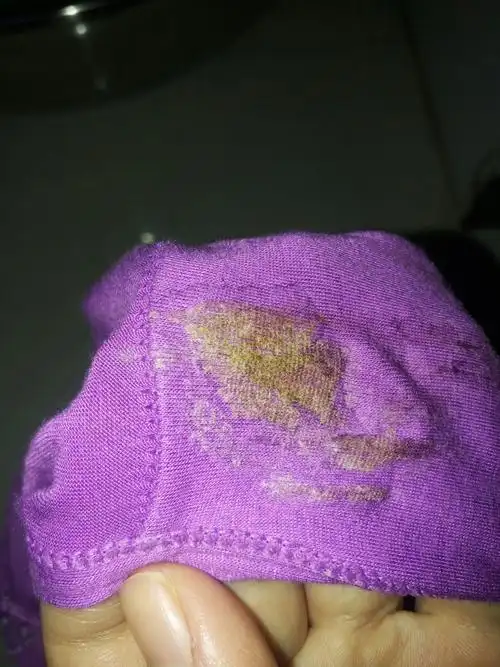 我老婆怀孕50天了,这两天内裤里面有脏东西暗黄的,请问医生这是怎么