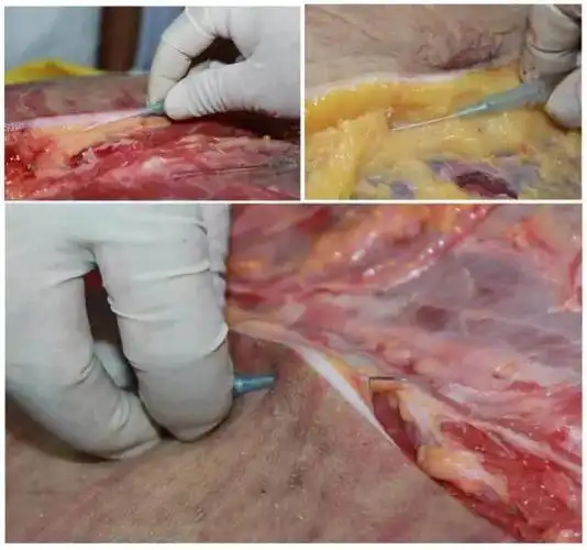 没有解剖学就没有医学2019年1月12日全国第十一届深圳新鲜尸体解剖班