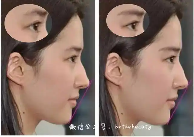 为什么有的人正面好看有的人侧面好看