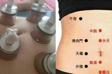 拔罐减肚子拔哪里图解教大家几招快速瘦身