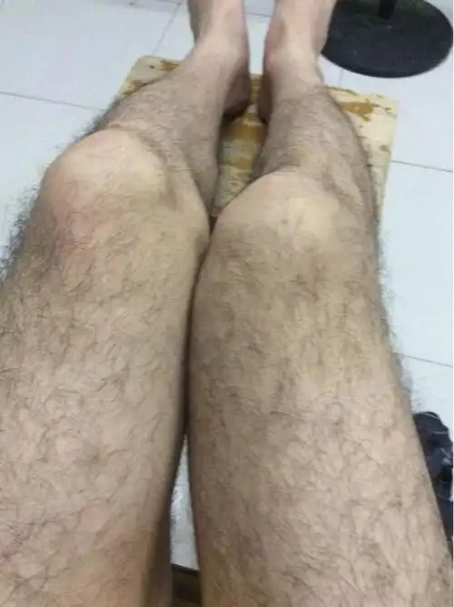 浓密的,就更应该进行脱毛,挽救自己的形象,但是你知道腿毛多怎么办?