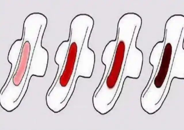 为什么月经走后会出现褐色分泌物现在就告诉你答案