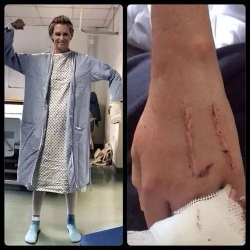 她因"自杀式"的表演意外截肢,如今这道伤疤却成了她最拽的标志