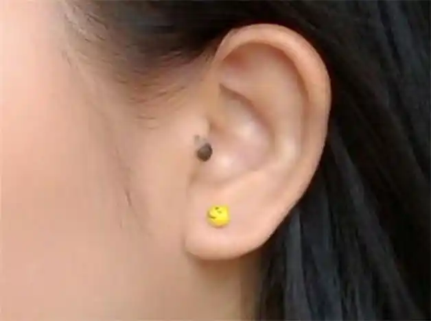 耳朵长痣聪明吗 有福没福怎么看