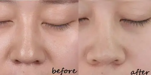 3款热门清洁面膜大pk!哪个才是真的毛孔吸尘器?