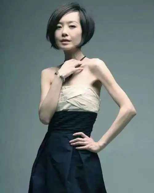 6位瘦成"纸片人"的明星,各有各的心酸,娱乐圈太"狠"了插图