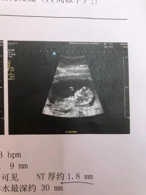 nt一次过帮我看看是小男生还是小女生呀