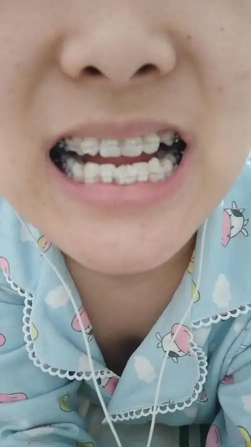 2.12牙齿闭合不上惹