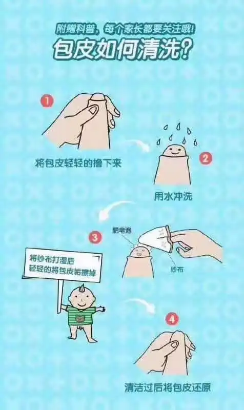 如何给孩子清洗包皮 日照现代男科医院