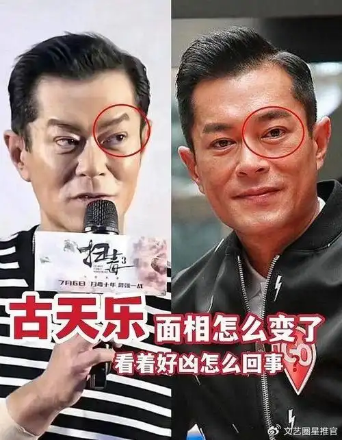 53岁古天乐近照遭吐槽凶神恶煞,被质疑打针拉皮过度导致医美失败