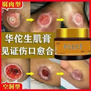 贴老年糖尿足病卧床压疮膏褥疮膏老烂腿屁股红玉膏辱疮药膏1人付款60
