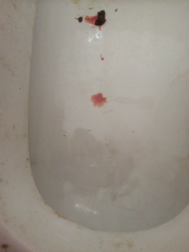 刚刚上厕所又流了几滴血了