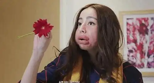 迪丽热巴勇于"自黑",这个脸肿得像小猪头一样的是迪丽热巴吗?