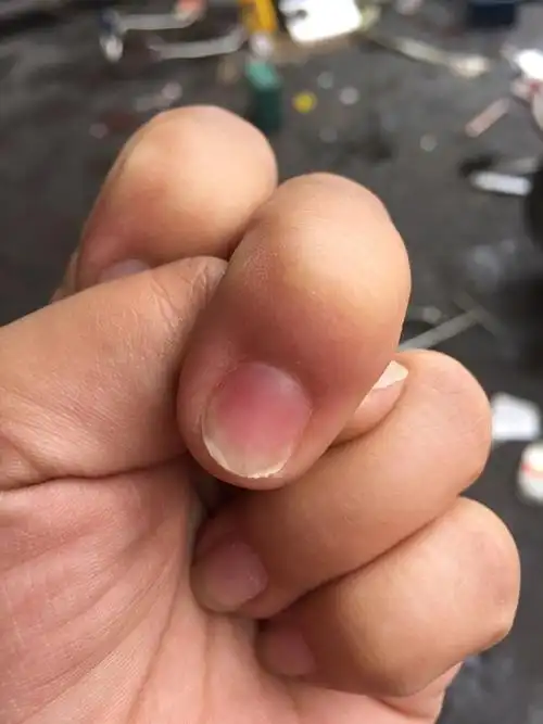 指甲分层了,看这挺恐怖了05.