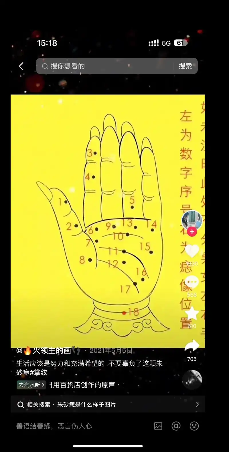 左手痣 #玄学 #不可思议 - 抖音