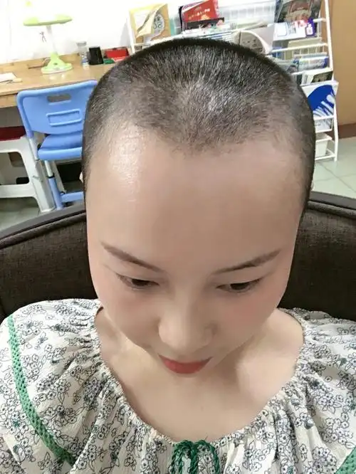 剃光头有用!