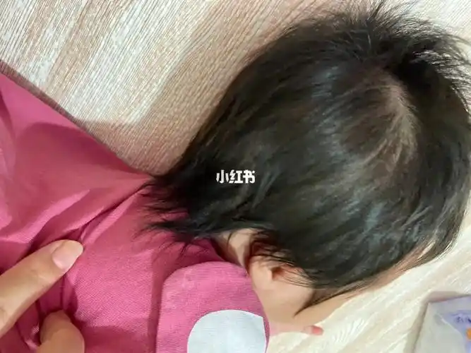 两个多月的宝宝头发好长建议剪短一点嘛