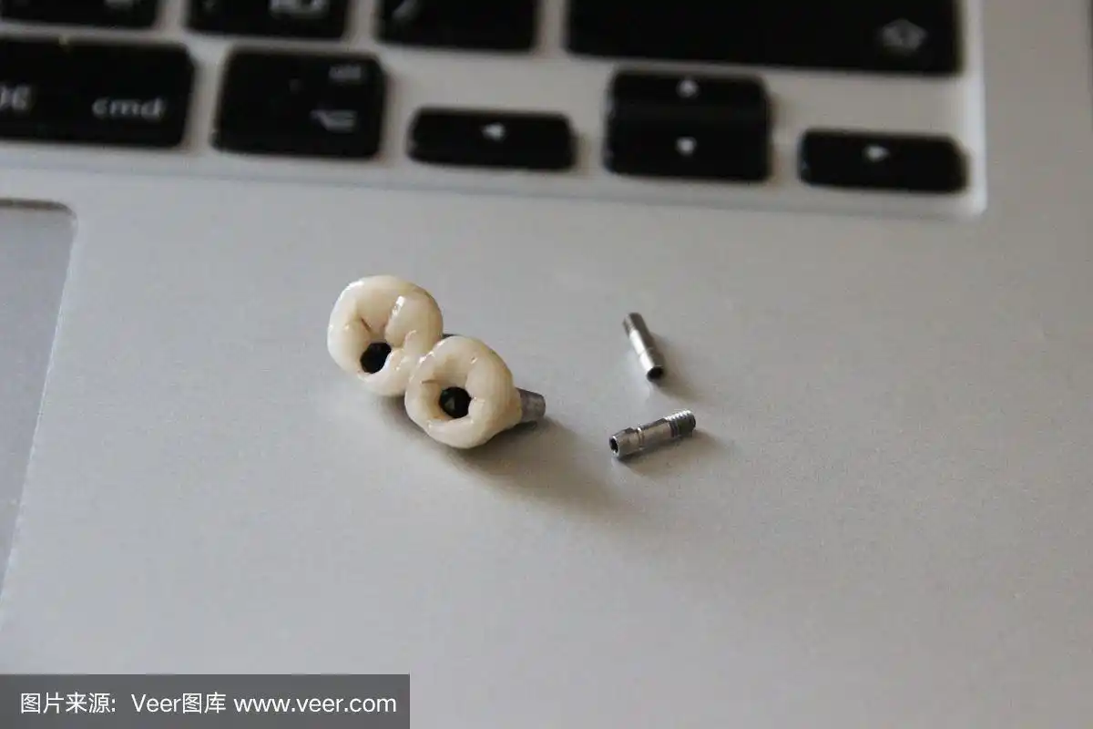 双冠种植牙和一对螺丝上的笔记本电脑键盘