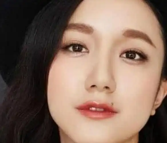 真正的有美人痣的明星图片 美人痣最佳位置是哪里