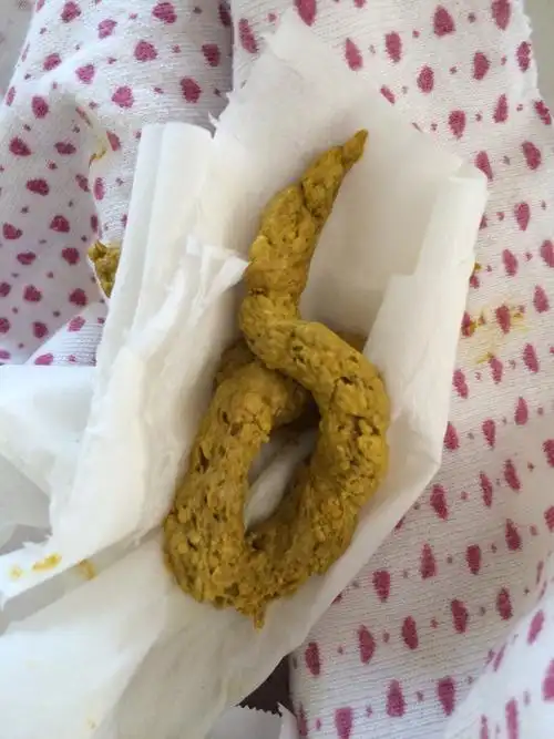 宝妈们我宝宝20天,图片的大便会不会很干?