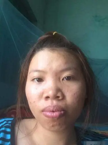 狠心花几十万整容后,结果令人傻眼了