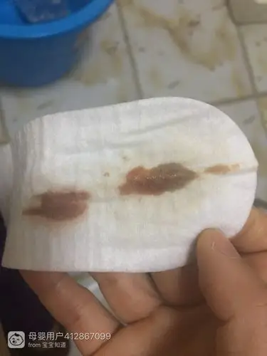 我在怀孕30多天到现在40多天了,一直流褐色的血医院检查一切都正常 有