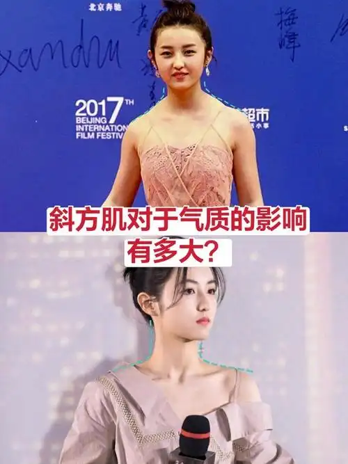 斜方肌对于气质的影响有多大