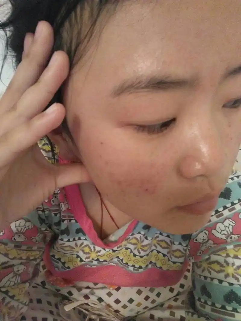 脸油肤色暗,肤色不均匀,怎么回事