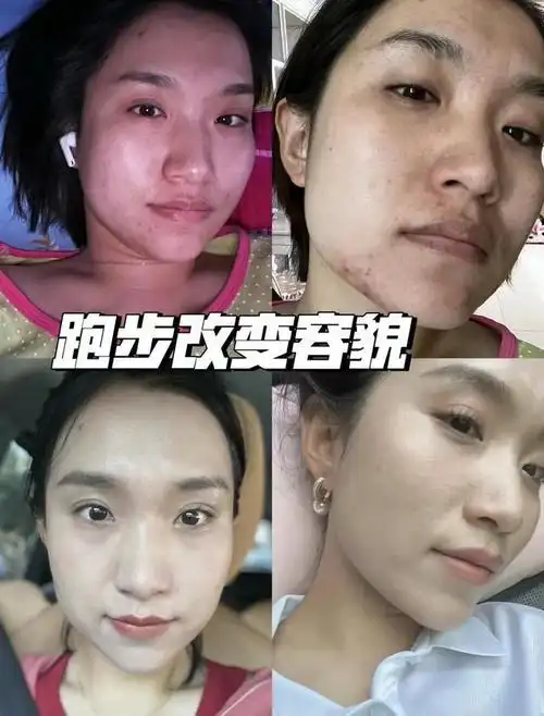 跑步前后对比的差别,肉眼可见,跑步半个月后皮肤不再暗沉发黄,变得