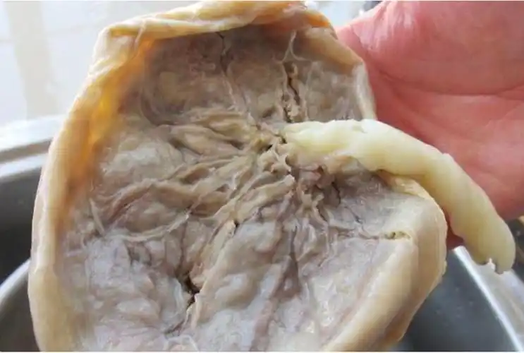 婴儿胎盘的功效与作用(新生儿的) - 乐宝宝贝