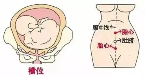 当然了,根据胎心的位置只能大概了解宝宝的胎位,如果想要确定宝宝的