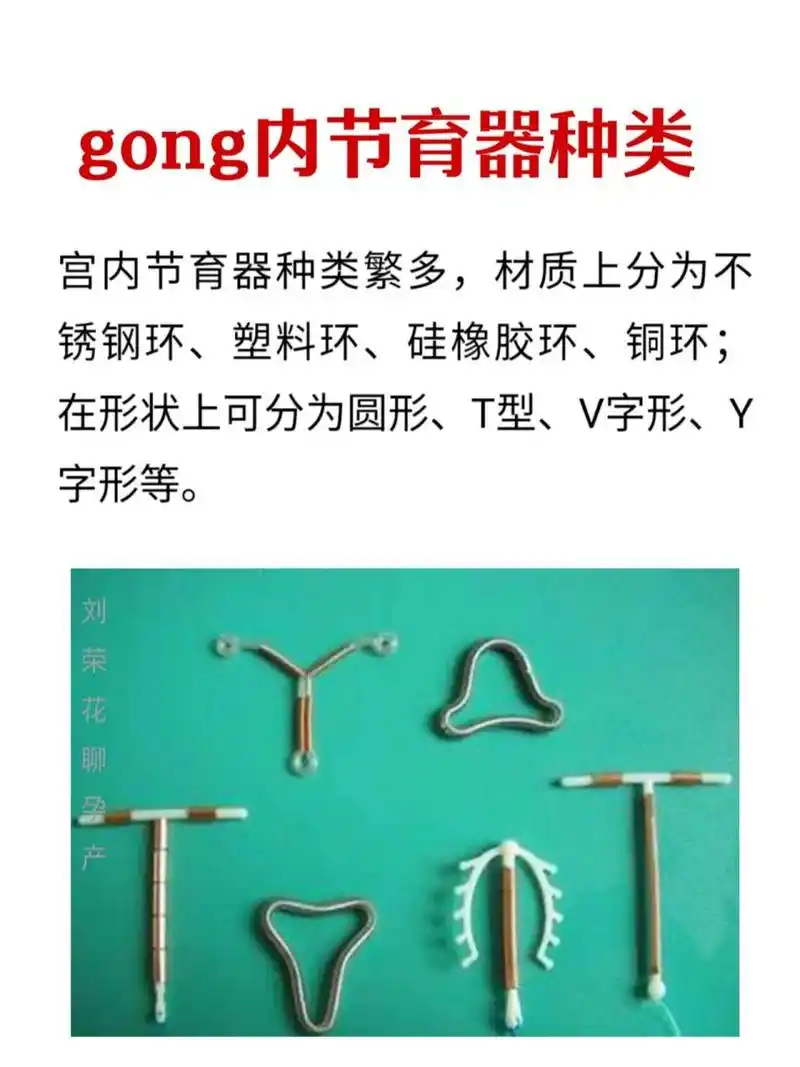 宫内节育环的种类 宫内节育环形状