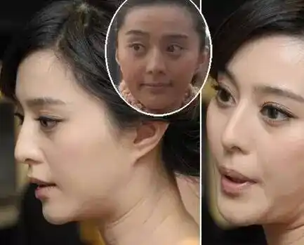 46岁的她做了10几项整形,年轻了17岁!