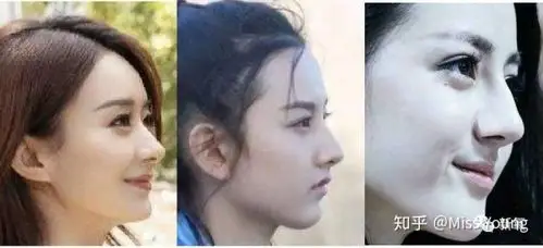 下面再来一组高鼻梁的山根对比,大家感受下赵丽颖的"低山根".