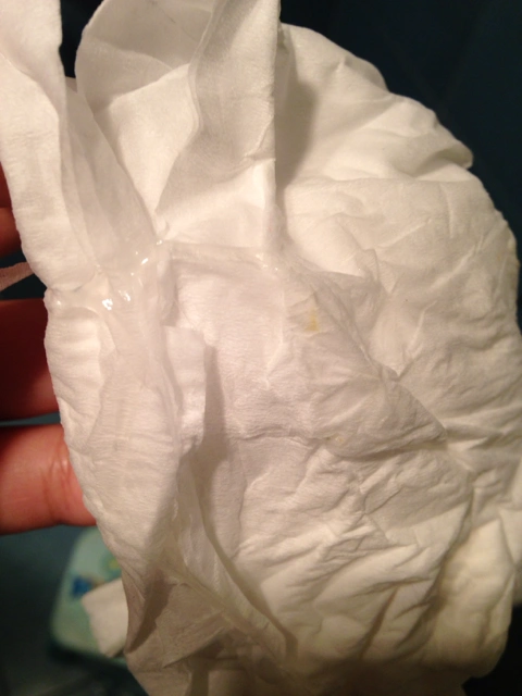 [优生备孕帮]排卵期有白带拉丝是什么原因