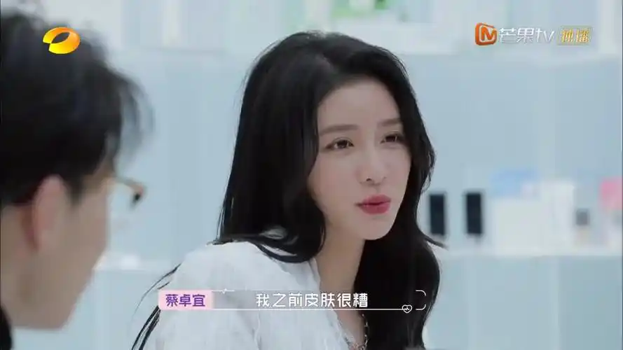 怦然再心动蔡卓宜的的皮肤状态不好曾经还因为这个看医生