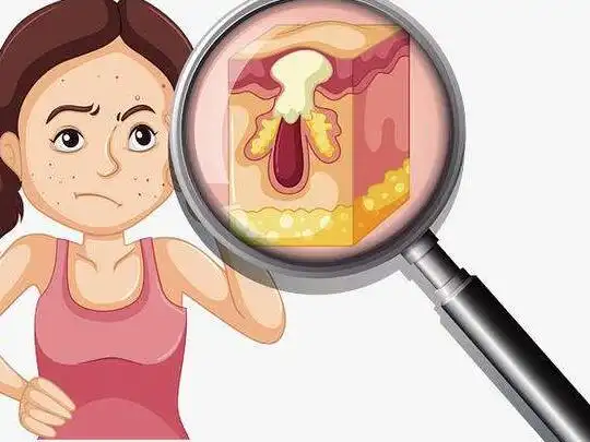 毛孔堵塞一周要清洁几次