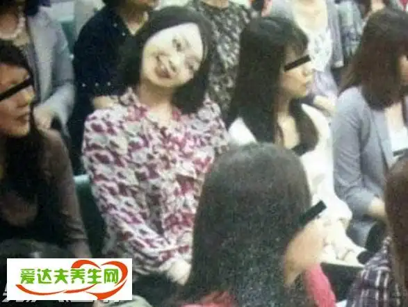 不少人看到歪头姐的照片都被吓得不轻,毕竟这样恐怖的现象只有在一些