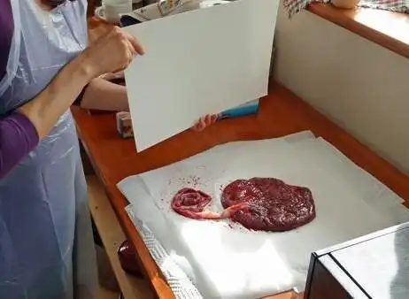 孩子出生后胎盘怎么处理家属胎盘是补品要带回家炖来吃