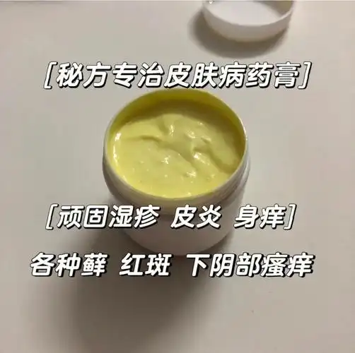 汗斑,消炎等等)如果有各种顽固性皮肤问题可以根据个人情况配药膏