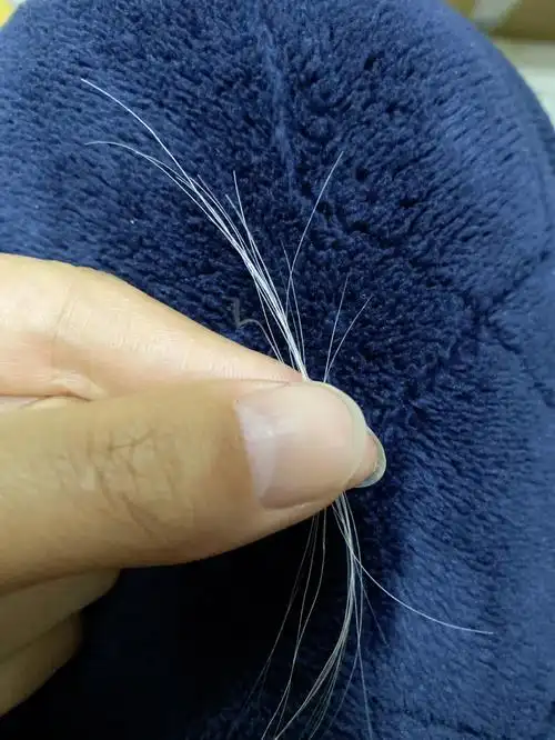 白头发有可以医的药吗