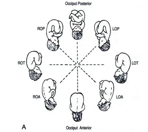 什么是胎方位示意图_有来医生