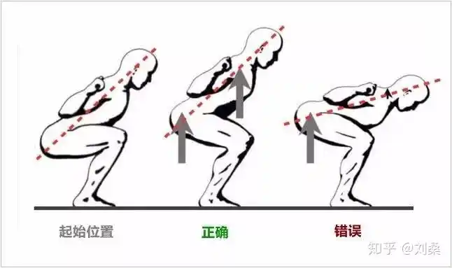 深蹲硬拉与运动性腰痛下