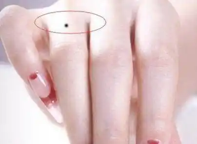 右手大拇指有痣的女人命运,大拇指上的痣大富大贵痣