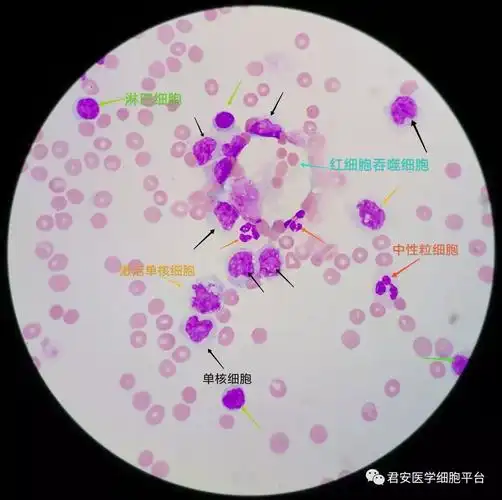 脑脊液单核巨噬细胞的别样风情