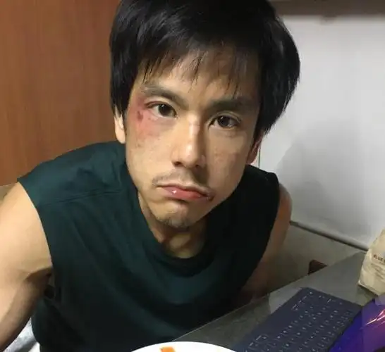 越瘦越难看的男明星:罗云熙幻灭,黄晓明精神憔悴,张若昀纸片人