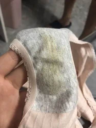 白带这个颜色是咋回事啊?有没有类似的情况的姐妹啊